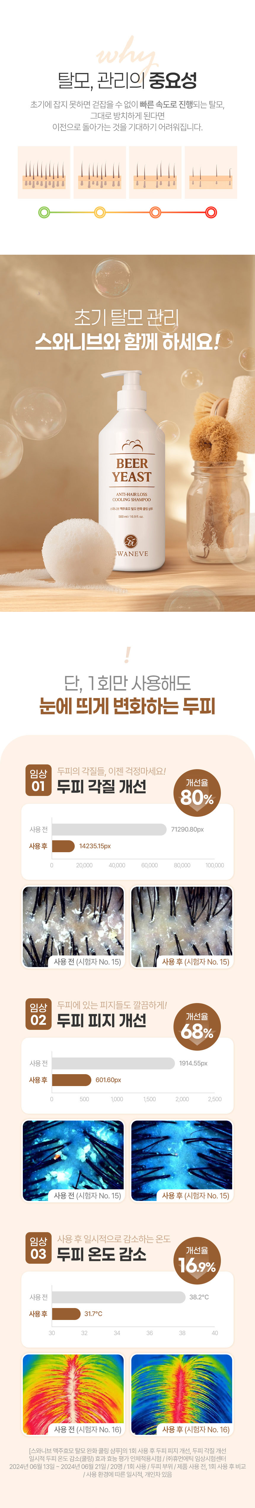 스와니브,맥주효모,탈모완화,쿨링샴푸,샴푸,두피온도감소,각질개선,피지개선