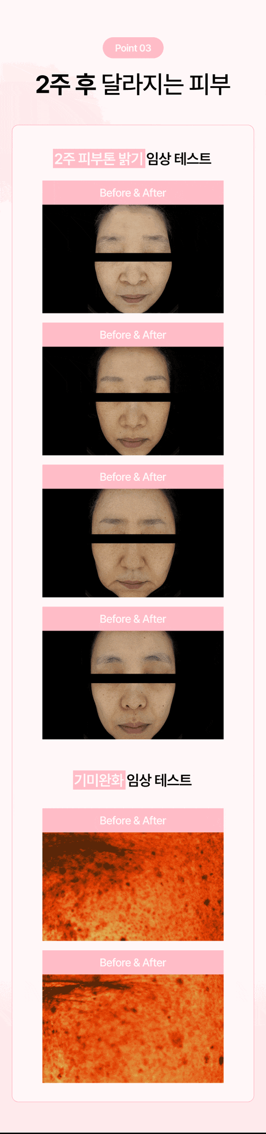 나이아신아마이드,미백기능성,비건화장품,민감성화장품,잡티케어,기초화장품,미백크림,미백에센스,미백토너,스킨케어세트