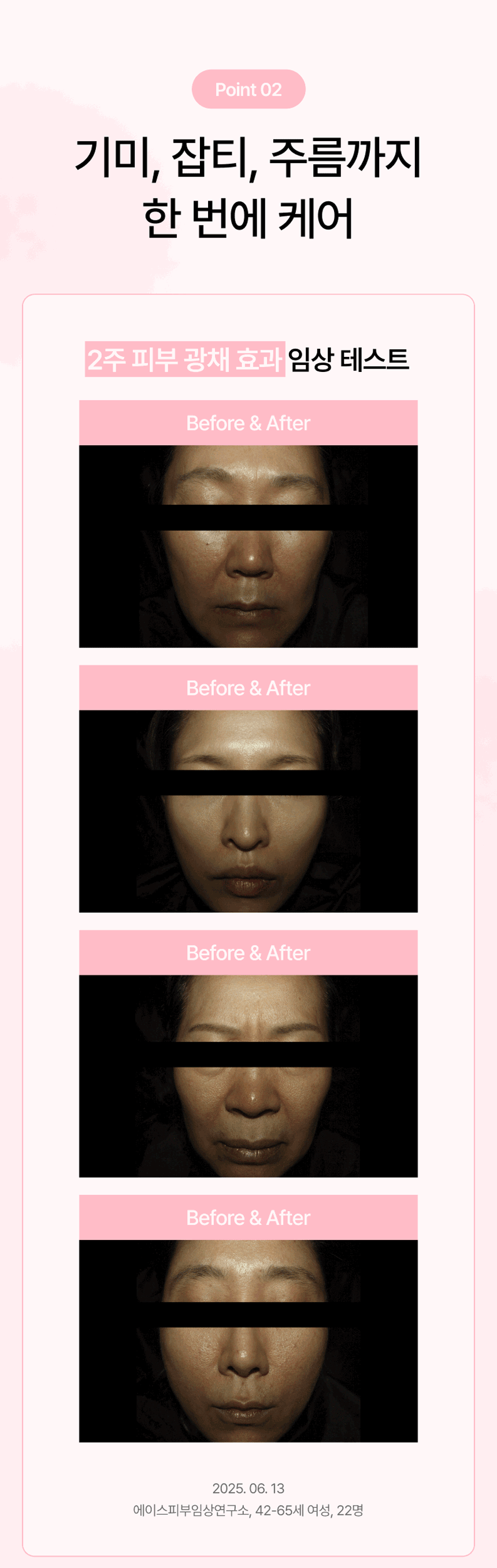 나이아신아마이드,미백기능성,비건화장품,민감성화장품,잡티케어,기초화장품,미백크림,미백에센스,미백토너,스킨케어세트
